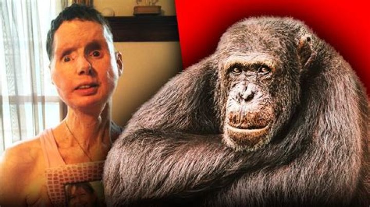 
Here’s Everything You Need to Know About Why Is Charla Nash’s Face So Different 