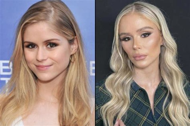 
Lai Austria Boyfriend: Who Is She Dating? Plastic Surgery Before And After 